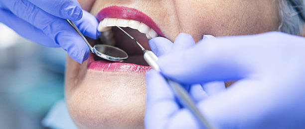 Best Emergency Dentist for Lost Fillings or Crowns in Aust, IN